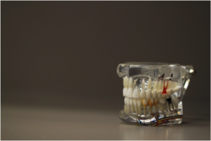 dentures